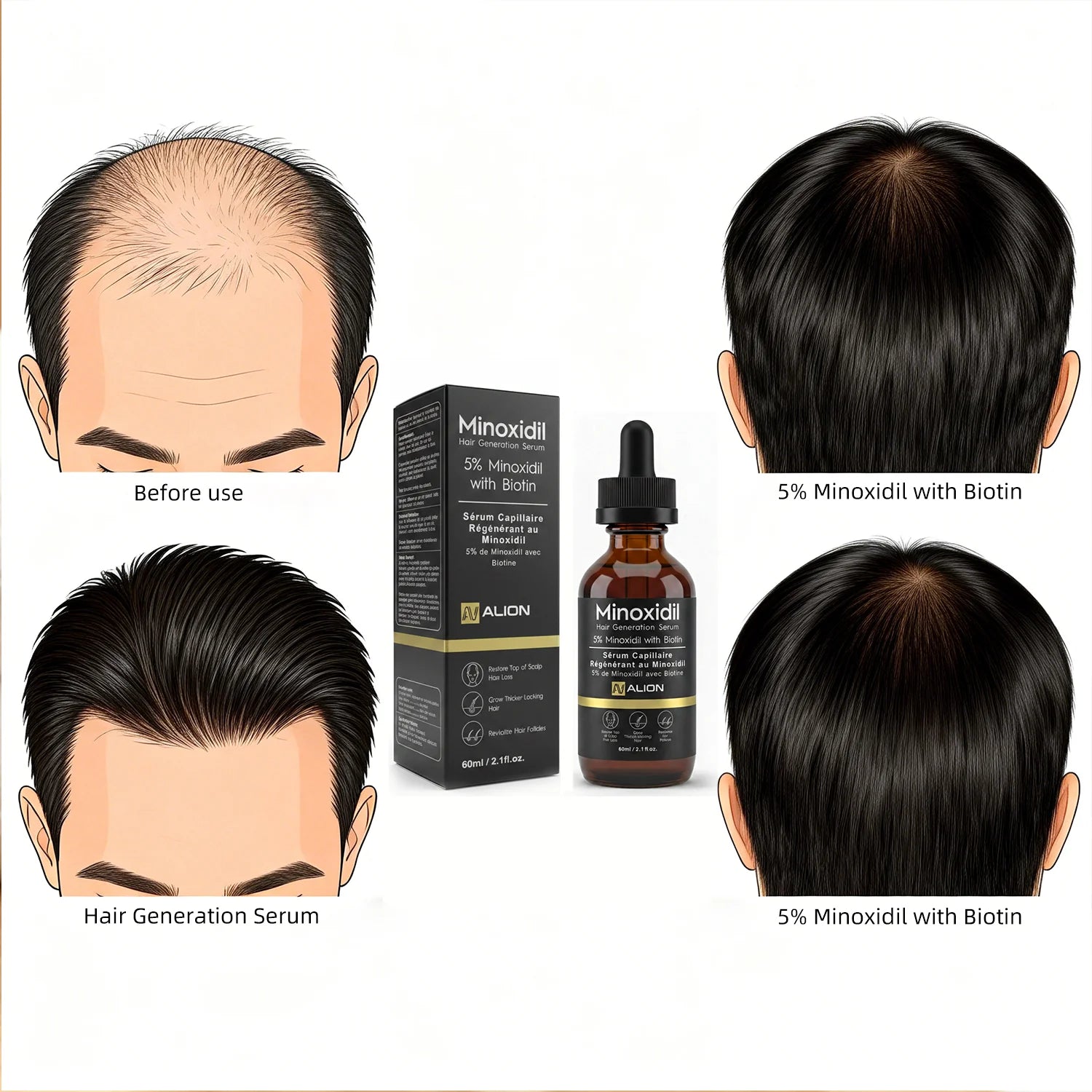 Minoxidil