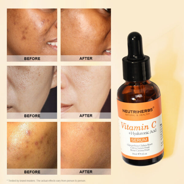 Vitamin C Serum - Image 2